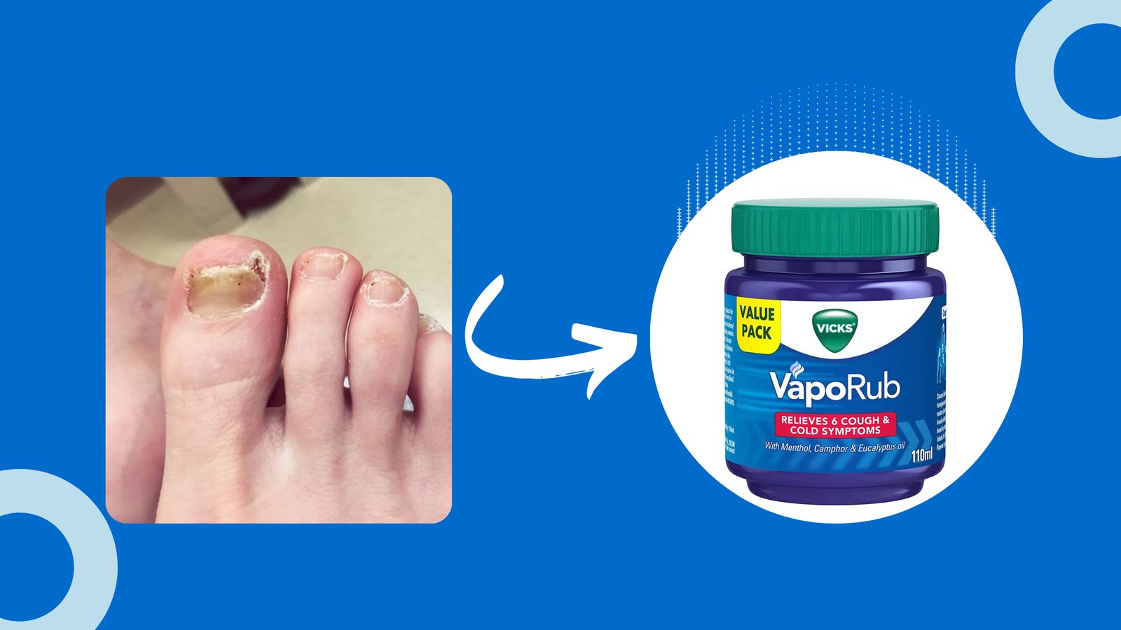 Vicks Vaporub For Toenail Fungus Treatment Is It A Myth